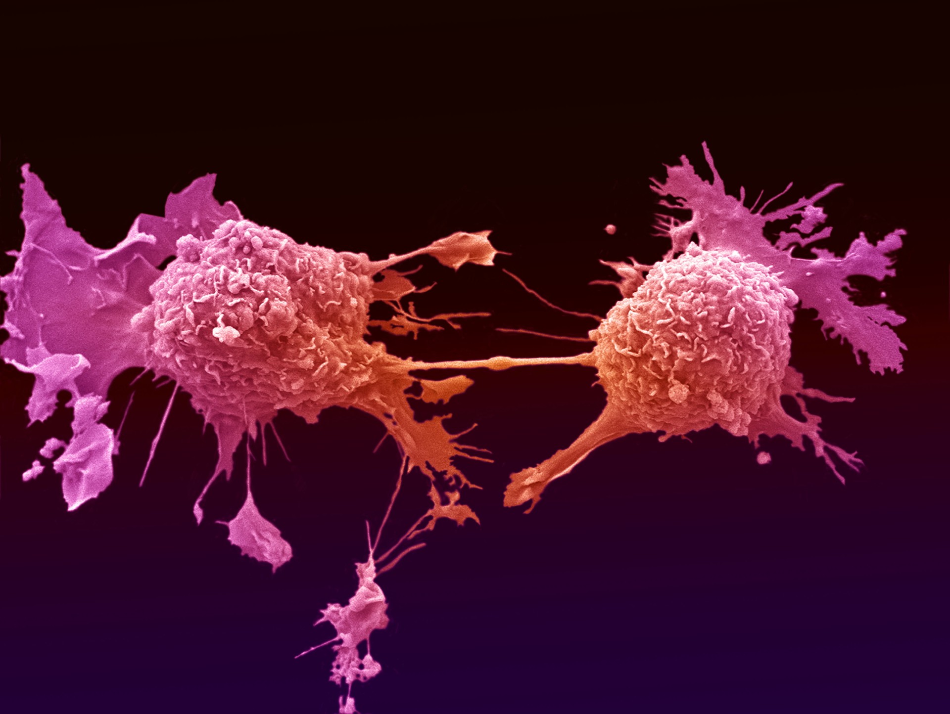 ارایه دی سی تراپی در سرطان توسط دکتر عباس زادگان در سمینار ژن، سلول، بافت